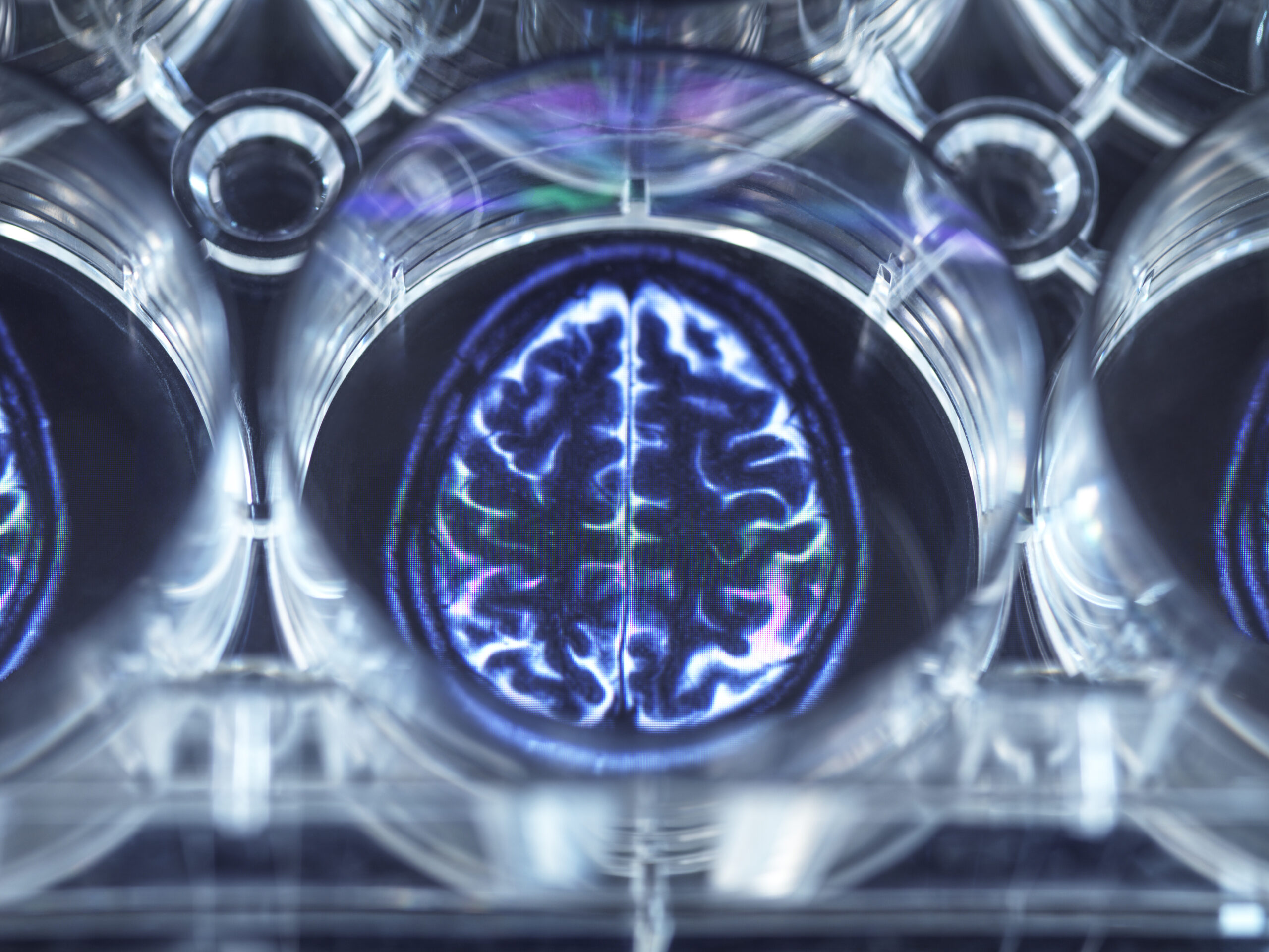 Understanding Transcranial Magnetic Stimulation (TMS): Basics, Process and Benefits